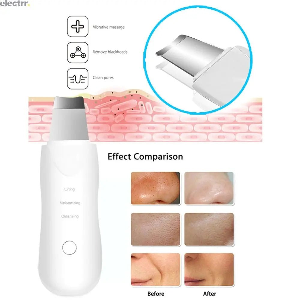 Personal Care Acne Pore Beauty Equipment Facial Cleaner Ion Ultrasonic Skin Scrubber | Electrr Inc